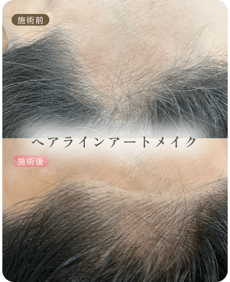 ビフォーアフター