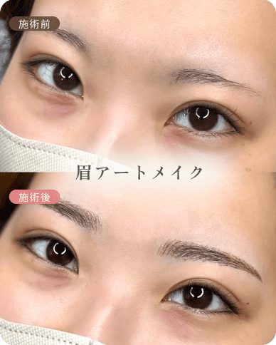 ビフォーアフター