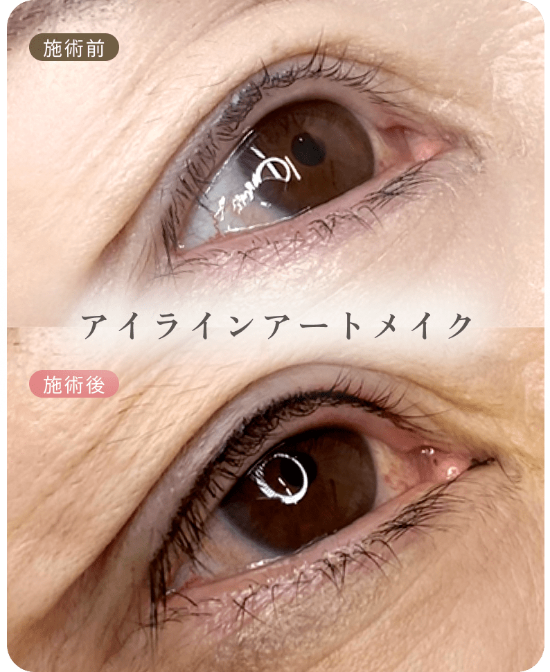 ビフォーアフター