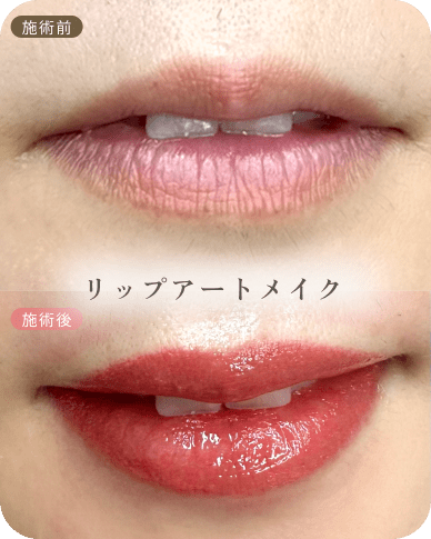 ビフォーアフター