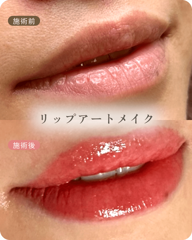 ビフォーアフター