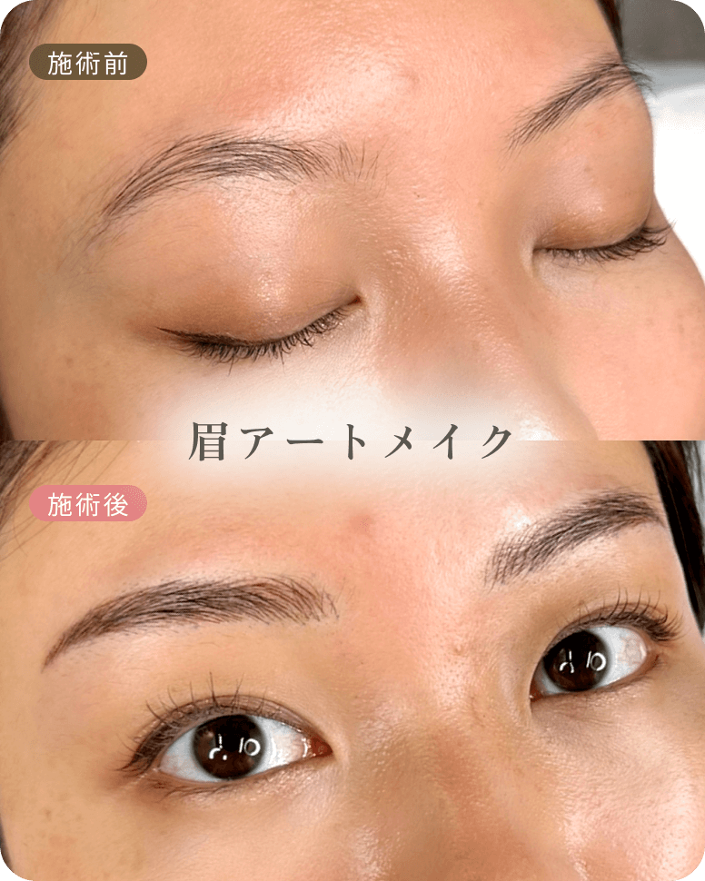 ビフォーアフター